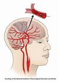 what does your body look like after a head-on collision