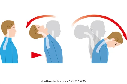 what does your body look like after a head-on collision